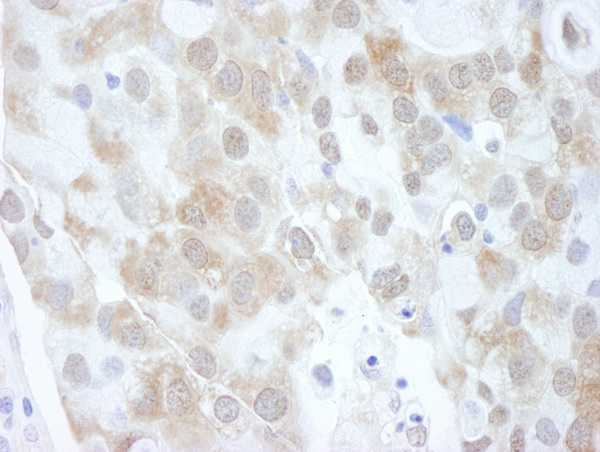 Immunohistochemistry (Formalin/PFA-fixed paraffin-embedded sections) - Anti-eIF4EBP1 antibody (AB2606), expandable thumbnail