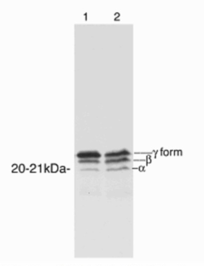 Western blot - Anti-eIF4EBP1 antibody (AB2606), expandable thumbnail