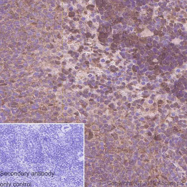 Immunohistochemistry (Formalin/PFA-fixed paraffin-embedded sections) - Anti-eIF4EBP1 antibody [Y329] (AB32024)