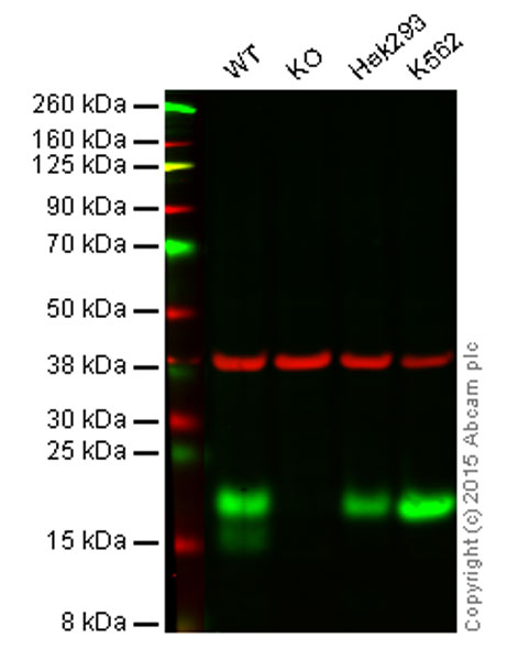Western blot - Anti-eIF4EBP1 antibody [Y329] (AB32024)