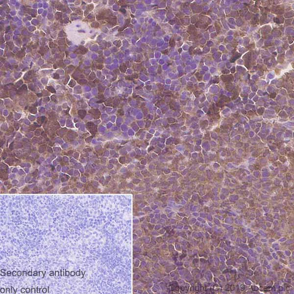Immunohistochemistry (Formalin/PFA-fixed paraffin-embedded sections) - Anti-eIF4EBP1 antibody [Y329] - BSA and Azide free (AB173370)