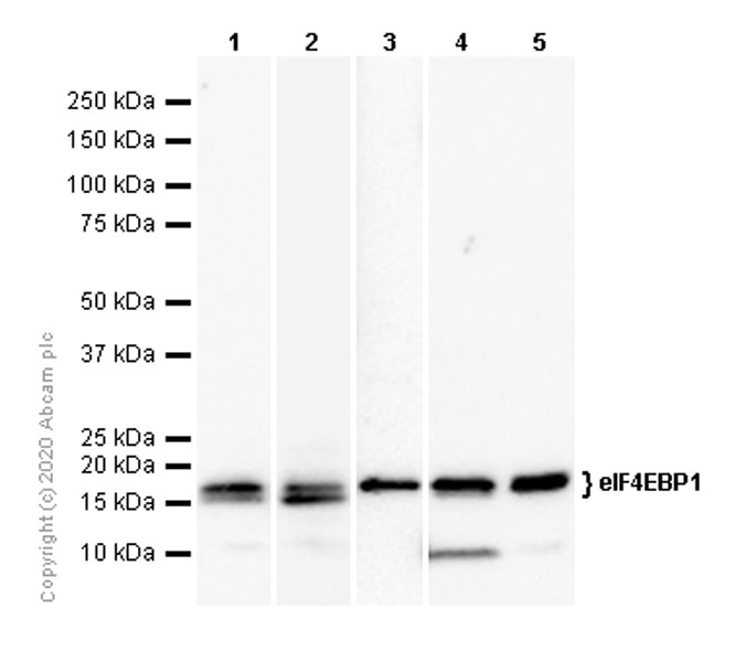 Western blot - Anti-eIF4EBP1 antibody [Y329] - BSA and Azide free (AB173370), expandable thumbnail