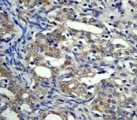 Immunohistochemistry (Formalin/PFA-fixed paraffin-embedded sections) - Anti-eIF4EBP1 antibody [Y330] (AB32130)