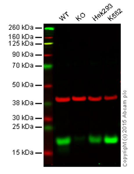 Western blot - Anti-eIF4EBP1 antibody [Y330] (AB32130), expandable thumbnail