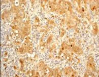 Immunohistochemistry (Formalin/PFA-fixed paraffin-embedded sections) - Anti-eIF4EBP1 + eIF4EBP2 + eIF4EBP3 (phospho T45) antibody [EPR2169Y] (AB68187)