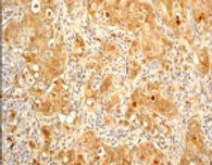 Immunohistochemistry (Formalin/PFA-fixed paraffin-embedded sections) - Anti-eIF4EBP1 + eIF4EBP2 + eIF4EBP3 (phospho T45) antibody [EPR2169Y] - BSA and Azide free (AB247374), expandable thumbnail