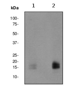 Western blot - Anti-eIF4EBP1 + eIF4EBP2 + eIF4EBP3 (phospho T45) antibody [EPR2169Y] - BSA and Azide free (AB247374), expandable thumbnail