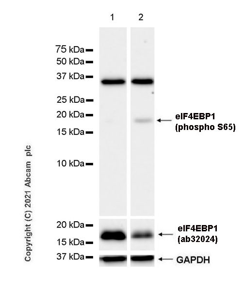 Western blot - Anti-eIF4EBP1 (phospho S65) antibody [EPR23889-3] (AB259329)