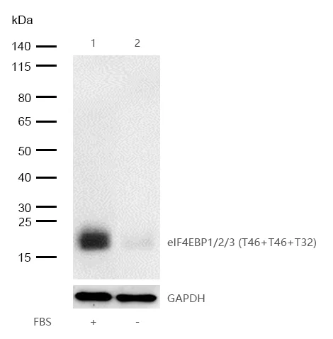 Western blot - Anti-eIF4EBP1 (phospho T32) + eIF4EBP2 (phospho T32) + eIF4EBP3 (phospho T46) antibody [SR4378] (AB326706)