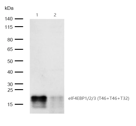 Western blot - Anti-eIF4EBP1 (phospho T32) + eIF4EBP2 (phospho T32) + eIF4EBP3 (phospho T46) antibody [SR4378] (AB326706)