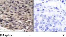 Immunohistochemistry (Formalin/PFA-fixed paraffin-embedded sections) - Anti-eIF4EBP1 (phospho T36) antibody (AB47365)