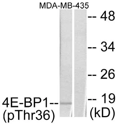 Western blot - Anti-eIF4EBP1 (phospho T36) antibody (AB47365)