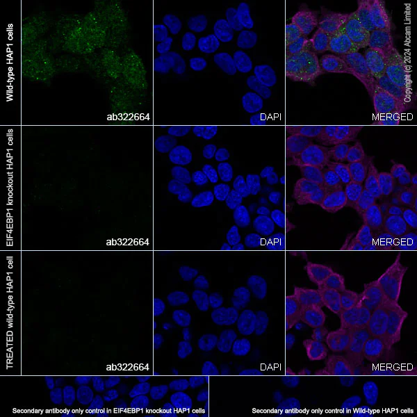 Immunocytochemistry/ Immunofluorescence - Anti-eIF4EBP1 (phospho T37) antibody [EPR28384-73] (AB322664)