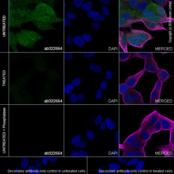 Immunocytochemistry/ Immunofluorescence - Anti-eIF4EBP1 (phospho T37) antibody [EPR28384-73] (AB322664)