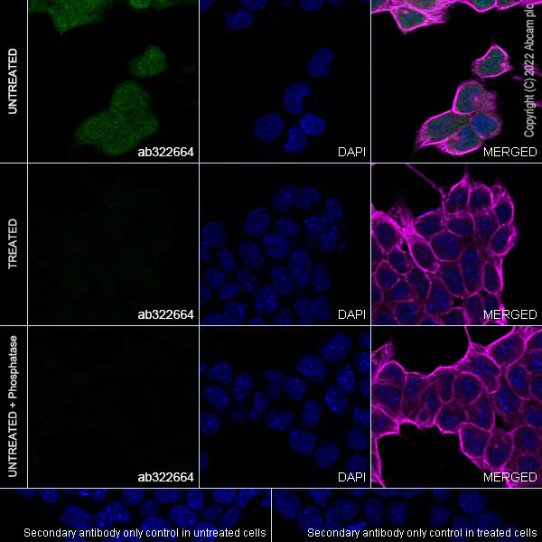 Immunocytochemistry/ Immunofluorescence - Anti-eIF4EBP1 (phospho T37) antibody [EPR28384-73] (AB322664)