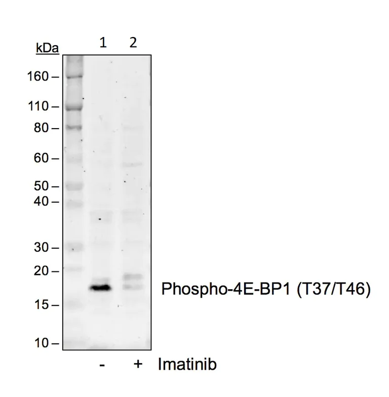 Western blot - Anti-eIF4EBP1 (phospho T37 + T46) antibody [4EB1T37T46-A5] (AB278686)