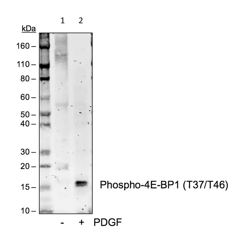 Western blot - Anti-eIF4EBP1 (phospho T37 + T46) antibody [4EB1T37T46-A5] (AB278686)