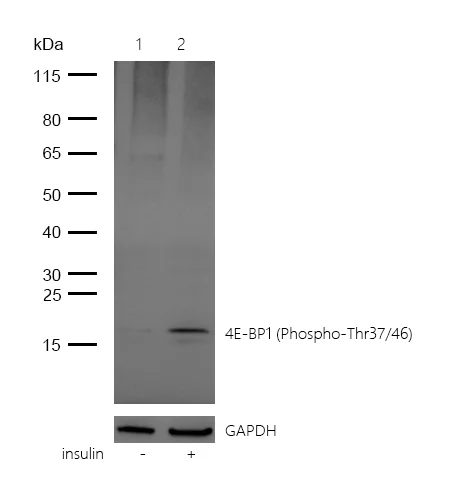 Western blot - Anti-eIF4EBP1 (phospho T37 + T46) antibody [SR4349] (AB326676)