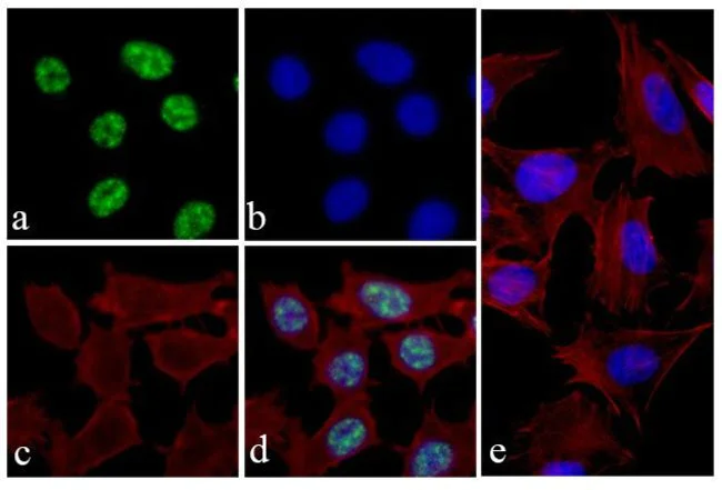 Immunocytochemistry - Anti-eIF4EBP1 (phospho T46) antibody [19HCLC] (AB277767)