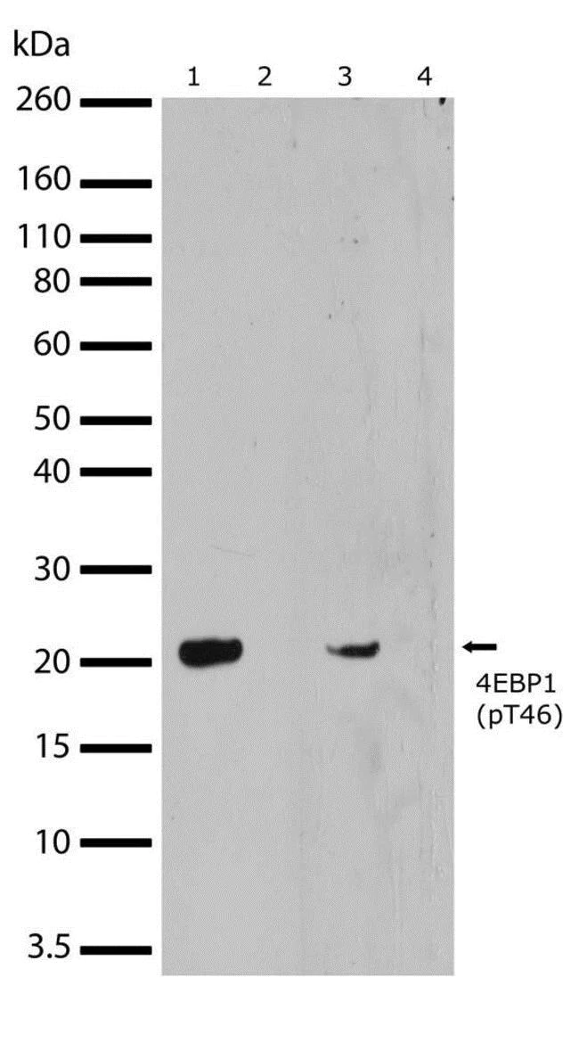 Western blot - Anti-eIF4EBP1 (phospho T46) antibody [19HCLC] (AB277767)