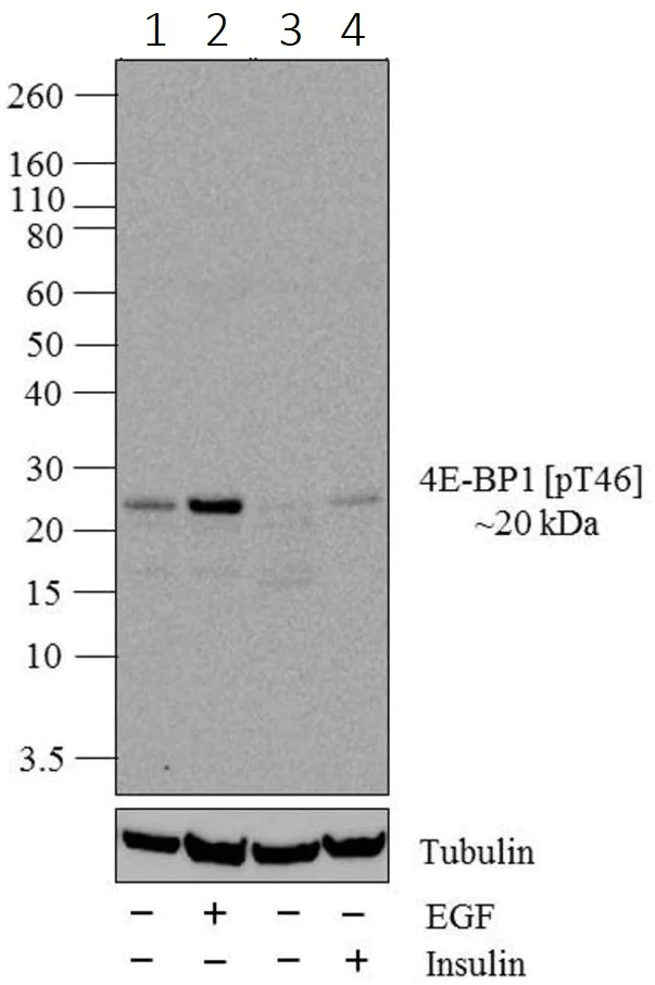 Western blot - Anti-eIF4EBP1 (phospho T46) antibody [19HCLC] (AB277767)