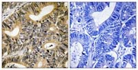 Immunohistochemistry (Formalin/PFA-fixed paraffin-embedded sections) - Anti-eIF4EBP1 (phospho T70) antibody (AB111421), expandable thumbnail