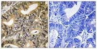 Immunohistochemistry (Formalin/PFA-fixed paraffin-embedded sections) - Anti-eIF4EBP1 (phospho T70) antibody (AB111421)
