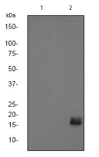 Western blot - Anti-eIF4EBP1 (phospho T70) antibody [EPR654(2)A] (AB75831)
