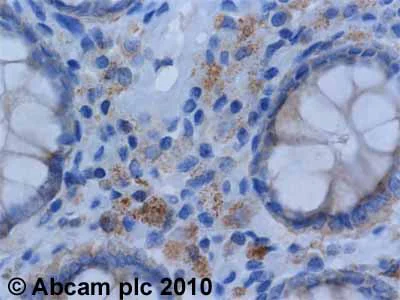 Immunohistochemistry (Formalin/PFA-fixed paraffin-embedded sections) - Anti-eIF4G1 antibody (AB2609)