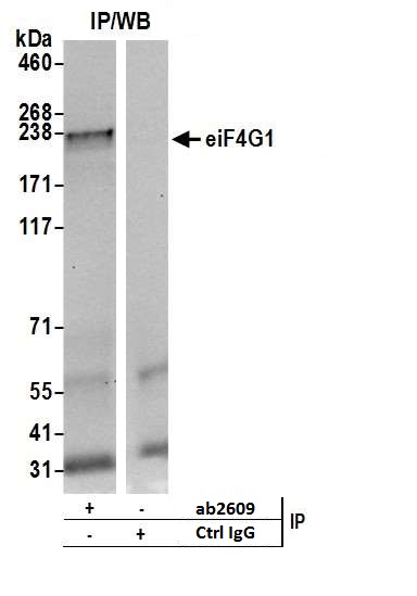 Immunoprecipitation - Anti-eIF4G1 antibody (AB2609), expandable thumbnail
