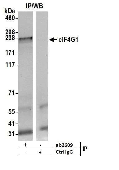 Immunoprecipitation - Anti-eIF4G1 antibody (AB2609)