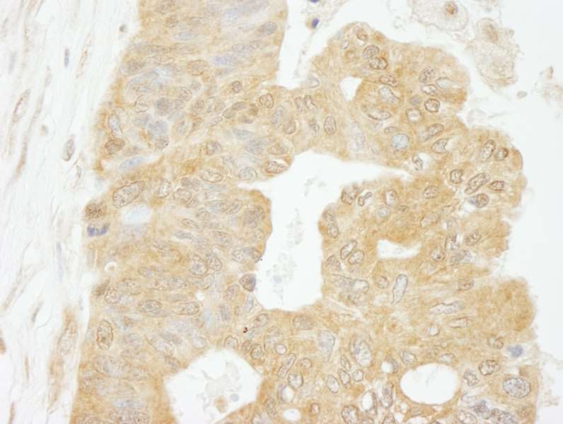 Immunohistochemistry (Formalin/PFA-fixed paraffin-embedded sections) - Anti-eIF4G1 antibody (AB264231)