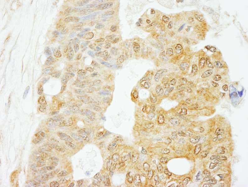 Immunohistochemistry (Formalin/PFA-fixed paraffin-embedded sections) - Anti-eIF4G1 antibody (AB264232)