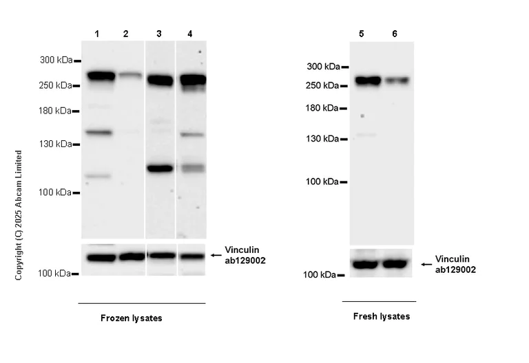 Western blot - Anti-eIF4G1 antibody [EPR30302-554] (AB324948)