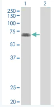Western blot - eIF4G1 overexpression 293T lysate (whole cell) (AB94246)