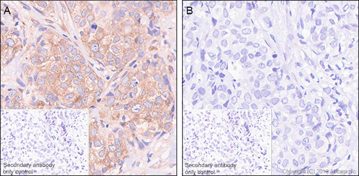 Immunohistochemistry (Formalin/PFA-fixed paraffin-embedded sections) - Anti-eIF4G1 (phospho S1108) antibody [SP351] (AB223502)