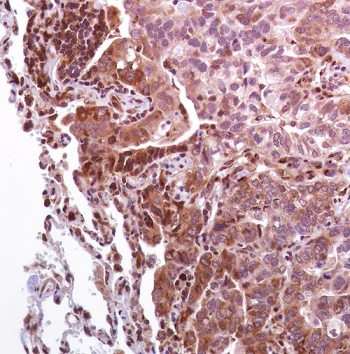 Immunohistochemistry (Formalin/PFA-fixed paraffin-embedded sections) - Anti-eIF4G1 (phospho S1108) antibody [SP351] (AB223502)