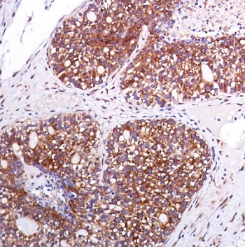 Immunohistochemistry (Formalin/PFA-fixed paraffin-embedded sections) - Anti-eIF4G1 (phospho S1108) antibody [SP351] - BSA and Azide free (AB242419), expandable thumbnail