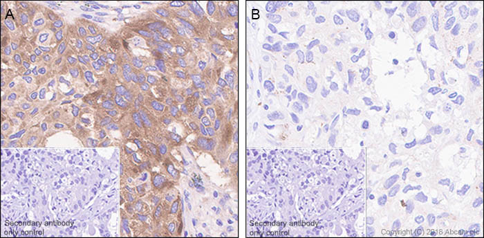 Immunohistochemistry (Formalin/PFA-fixed paraffin-embedded sections) - Anti-eIF4G1 (phospho S1108) antibody [SP351] - BSA and Azide free (AB242419), expandable thumbnail