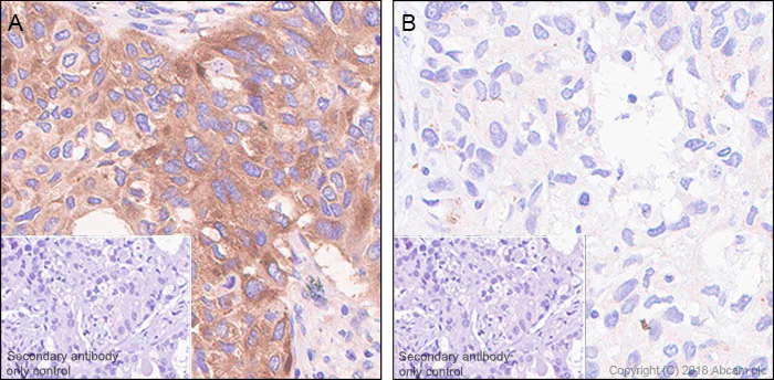 Immunohistochemistry (Formalin/PFA-fixed paraffin-embedded sections) - Anti-eIF4G1 (phospho S1108) antibody [SP351] - BSA and Azide free (AB242419)
