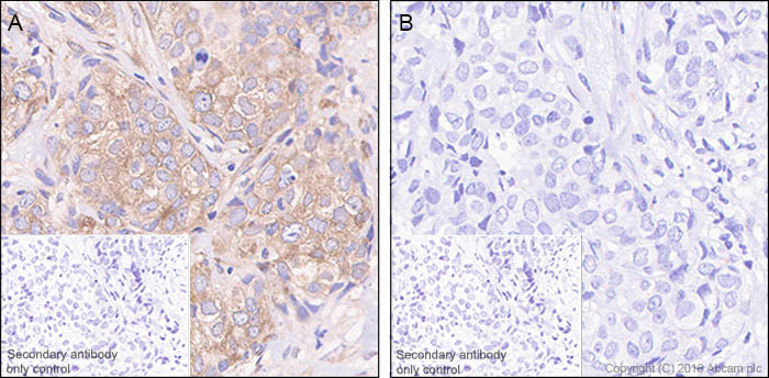 Immunohistochemistry (Formalin/PFA-fixed paraffin-embedded sections) - Anti-eIF4G1 (phospho S1108) antibody [SP351] - BSA and Azide free (AB242419), expandable thumbnail