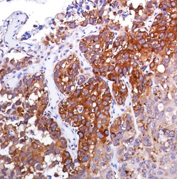 Immunohistochemistry (Formalin/PFA-fixed paraffin-embedded sections) - Anti-eIF4G1 (phospho S1108) antibody [SP351] - BSA and Azide free (AB242419)