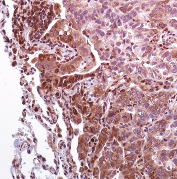 Immunohistochemistry (Formalin/PFA-fixed paraffin-embedded sections) - Anti-eIF4G1 (phospho S1108) antibody [SP351] - BSA and Azide free (AB242419), expandable thumbnail