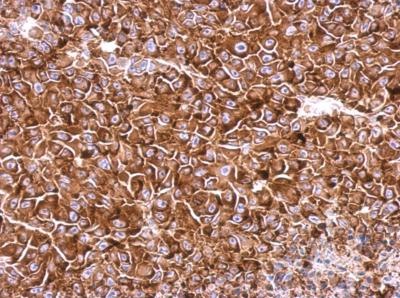 Immunohistochemistry (Formalin/PFA-fixed paraffin-embedded sections) - Anti-eIF4GII antibody - N-terminal (AB155482), expandable thumbnail