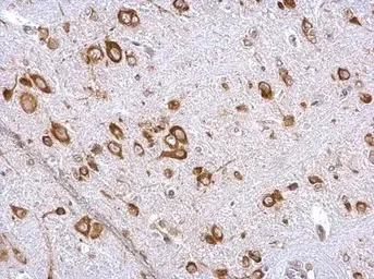 Immunohistochemistry (Formalin/PFA-fixed paraffin-embedded sections) - Anti-eIF4GII antibody - N-terminal (AB155482)