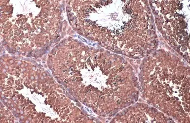Immunohistochemistry (Formalin/PFA-fixed paraffin-embedded sections) - Anti-eIF4GII antibody - N-terminal (AB155482)