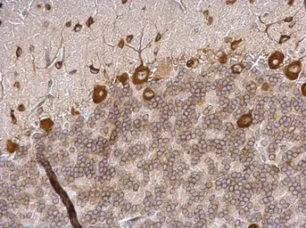 Immunohistochemistry (Formalin/PFA-fixed paraffin-embedded sections) - Anti-eIF4GII antibody - N-terminal (AB155482)