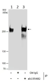 Immunoprecipitation - Anti-eIF4GII antibody - N-terminal (AB155482)