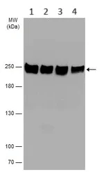 Western blot - Anti-eIF4GII antibody - N-terminal (AB155482)