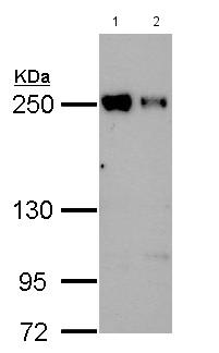 Western blot - Anti-eIF4GII antibody - N-terminal (AB155482), expandable thumbnail